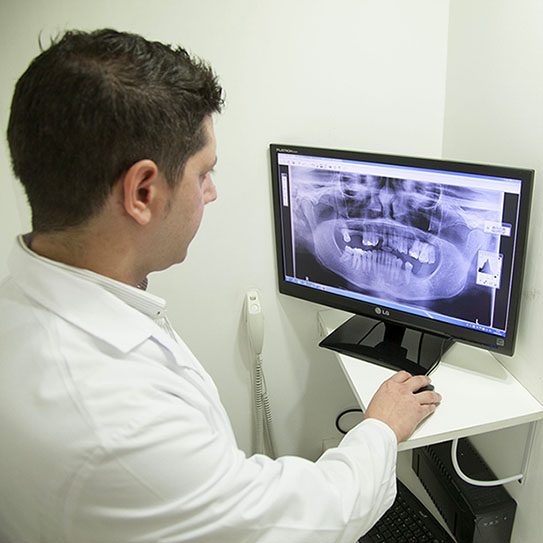 digital x-rays
