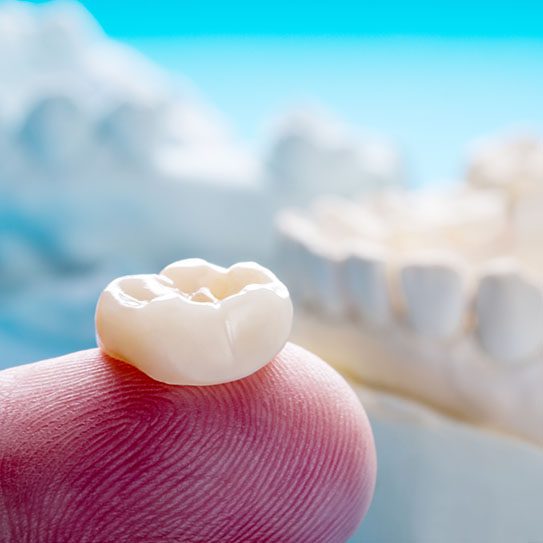 same-day crowns dental care in Snellville dental clinic